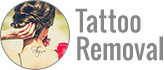 Tattoo Removal